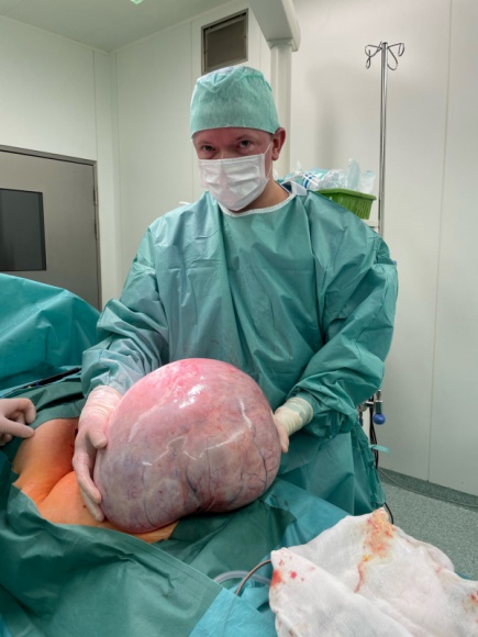 15-kilogramowy guz jajnika: przestroga, że warto robić regularne badania